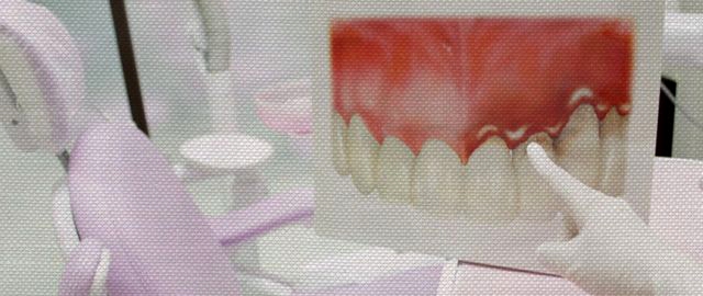 矯正歯科について